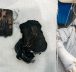 Portable charger explodes in bed, leaves woman with chemical burns